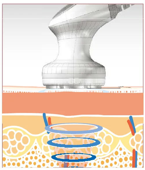 ビューティーポット Beauty Pot (複合痩身美容機器)キャビテーション ビューティーポット -Beauty Pot (複合痩身美容機器)-美容サロン商品の