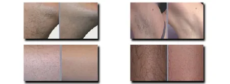 デュオフラッシュミニ-XX