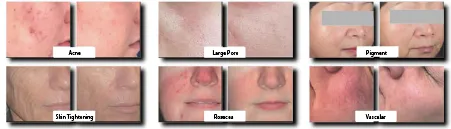 デュオフラッシュミニ-XX