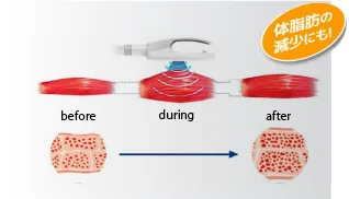 アブソリュート・マセクサー・ミニ