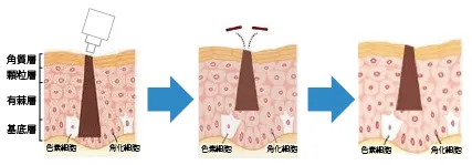 ピュアラディアンス