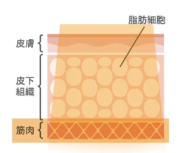 テスラウェーブネオ