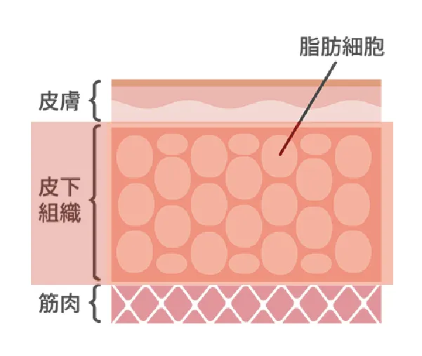 テスラウェーブネオ